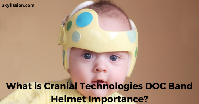 What is Cranial Technologies DOC Band Helmet Importance