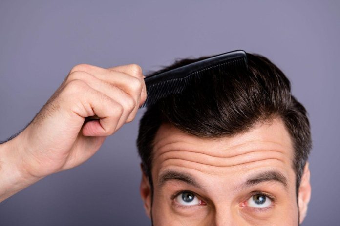 5 Best Hair Care Routines to Follow after a Hair Transplant