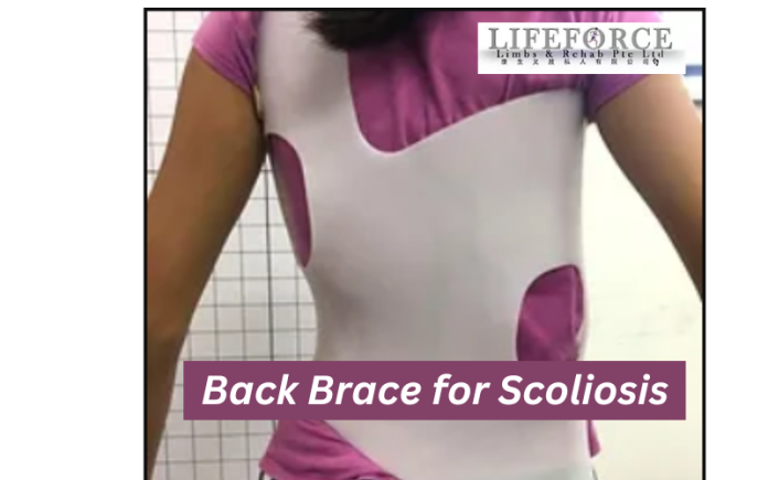 Back Brace for Scoliosis