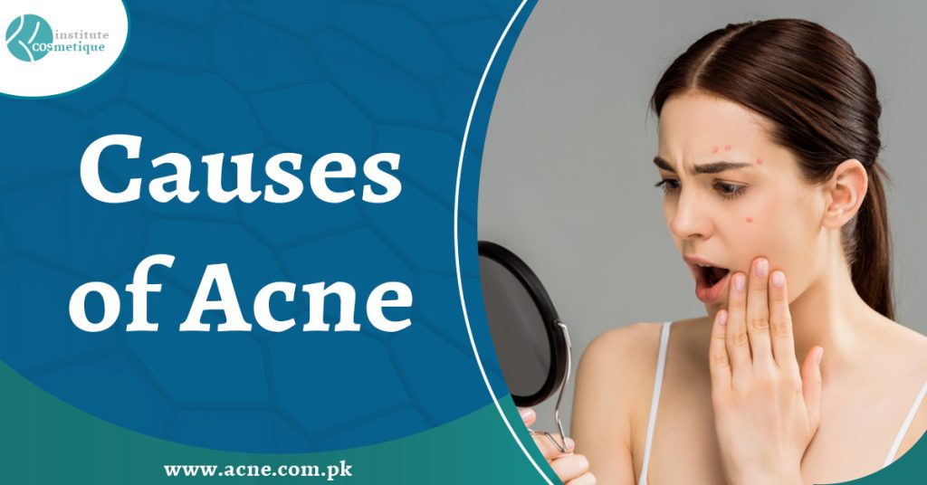 Best Skin specialists in Lahore for best acne treatment